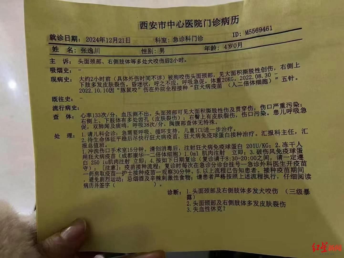 西安4歲男童遭惡犬襲擊，致臉部大面積創傷，目前仍在ICU昏迷 警方已在調查犬隻來源