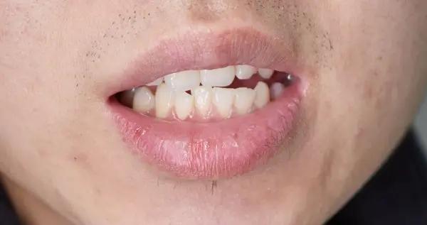 甜蜜的“陷阱”：喫糖背後那些不爲人知的健康隱患
