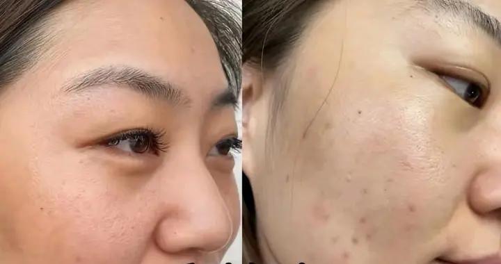 “堅持防曬”VS“偶爾防曬”皮膚有什麼差距？看完我再也不偷懶了