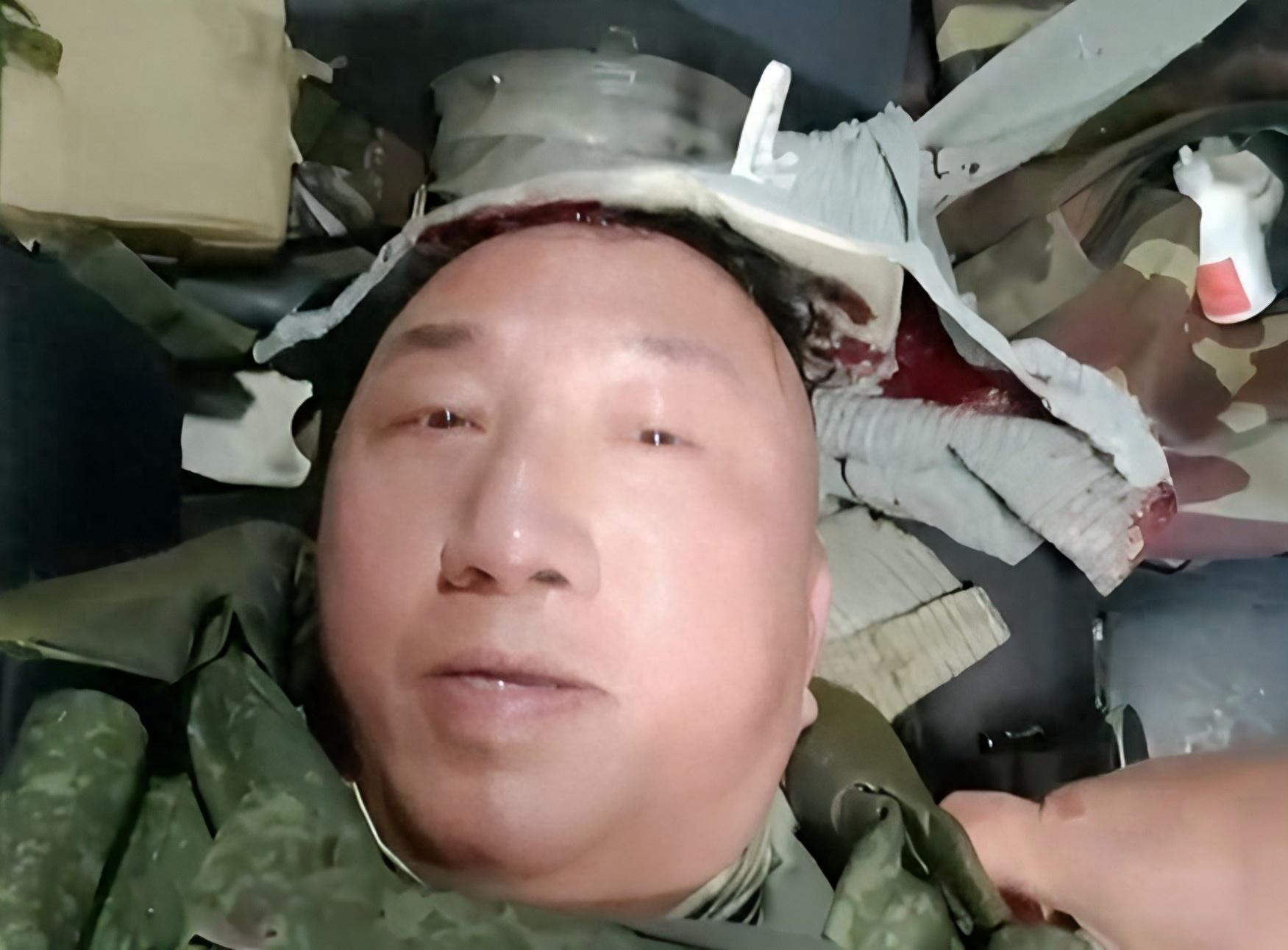庫州戰場出變故，中國記者遭炮火波及，普京政府用6字給事件定性