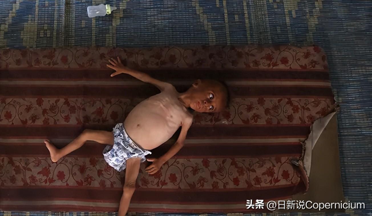 加沙死傷數萬！國際專家怒批以色列：這就是種族滅絕的鐵證！