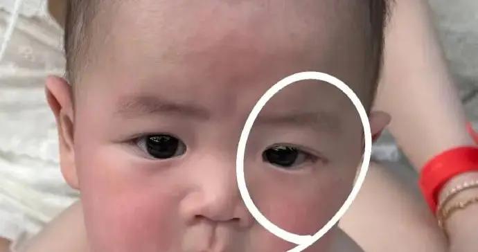 歐陽妮妮透露兒子鼻淚管阻塞 將進行疏通手術