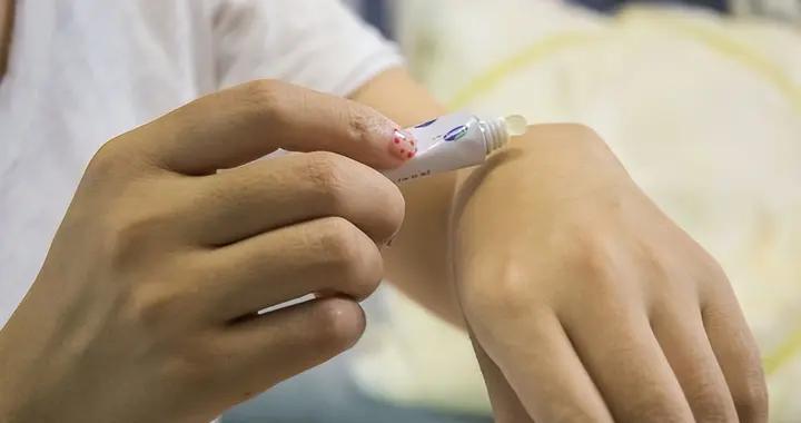 掉痂後擔心留疤？這些護理細節要做好，從清潔到防曬，一步不能錯