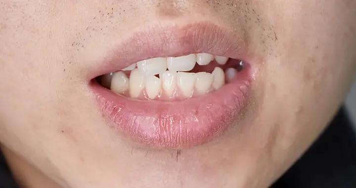 長期嘴裏發鹹查不到原因？試試這5個檢查，避免漏診問題