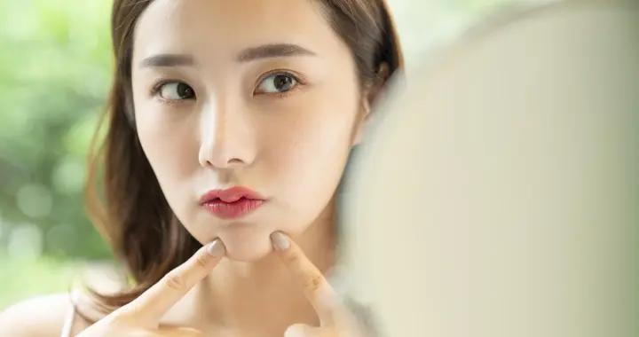 下巴反覆長痘？這些「排毒食物」幫你清理體內垃圾