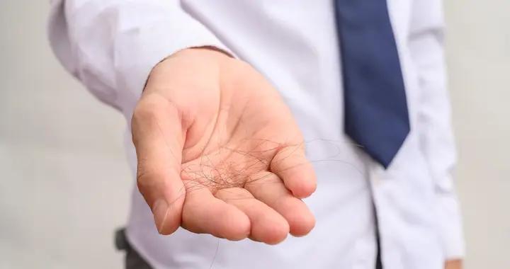 掉頭髮不全是缺營養！分清原因是關鍵，科學改善方法看這裏！