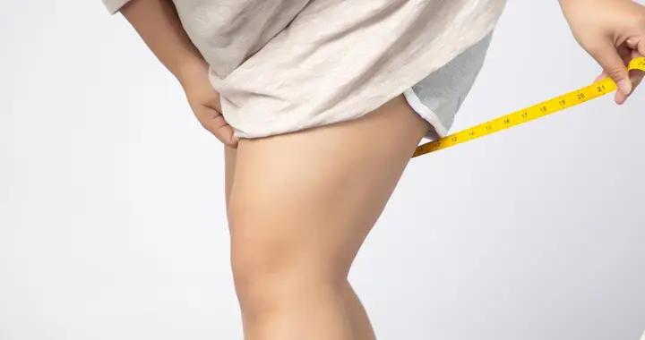 脂肪/肌肉/水腫腿怎麼瘦？科學方案來了