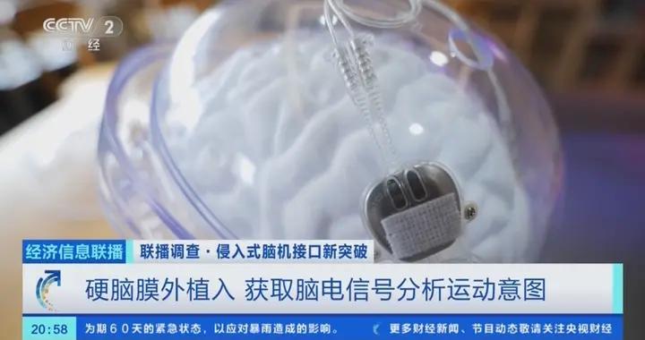 全球首款侵入式腦機接口醫療器械上市 能治什麼？效果如何？