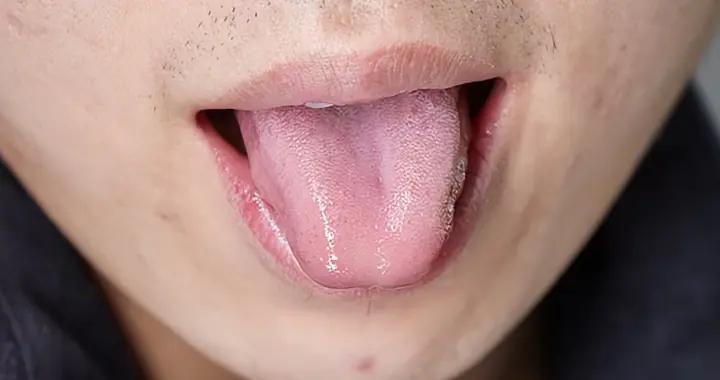 別讓溼氣纏上你！從舌苔到作息，全方位去溼攻略請收好