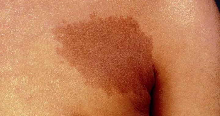 不是隻有日曬才長斑！這些隱藏誘因，很多人天天都在犯