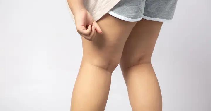 小腿粗到穿不上牛仔褲？3招分清類型，科學瘦出漫畫腿