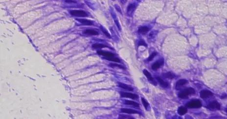 藥效飆升60倍！科學家改造老藥甲硝唑，可低劑量根治幽門螺桿菌