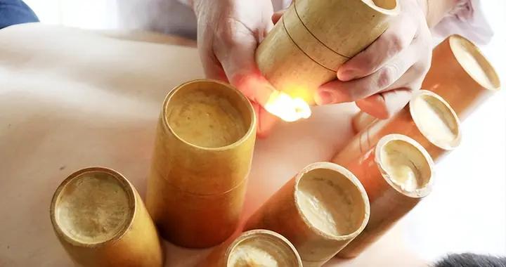 火罐的溫熱VS氣罐的安全，拔罐選對纔有效，誤區要避開