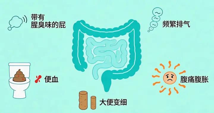 別把屁多當小事！27歲白領頻繁腹脹排氣，查出晚期腸癌