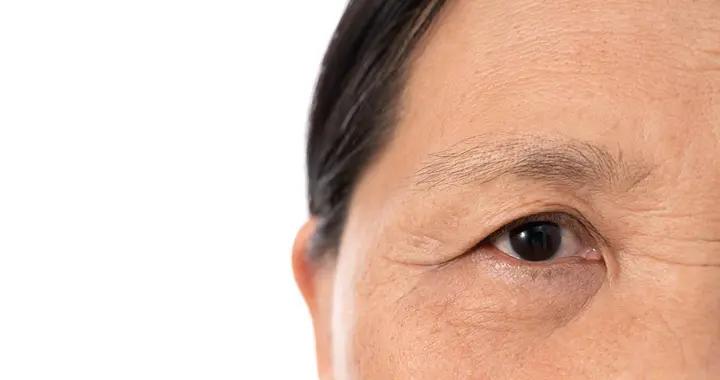 後悔沒早知道！皮膚鬆弛不是不可逆，這些日常習慣要堅持