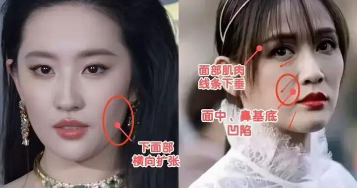 比“發腮”更可怕的是“苦相臉”！這3個特徵，中一個都顯老顯兇