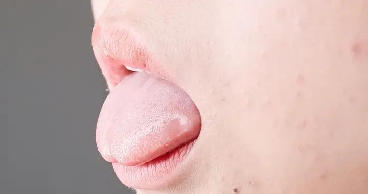 晨起看舌苔就知溼氣重不重！簡單實用的祛溼方法，在家就能做