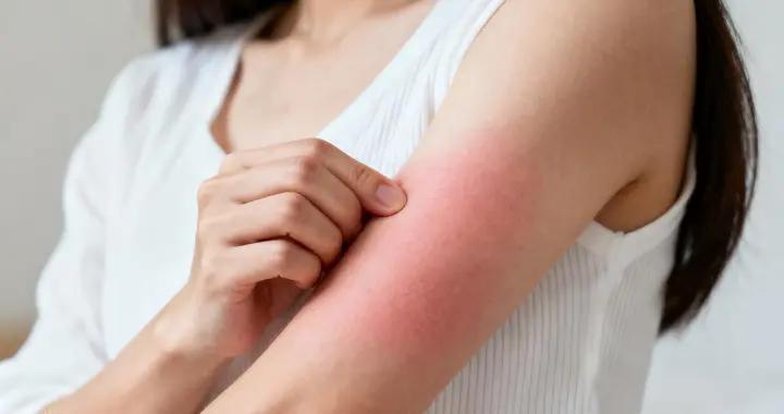 身上熱了就癢，是皮膚在“報警”？這些誘因你可能沒注意