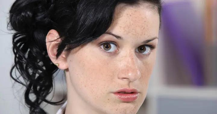 黃褐斑、雀斑怎麼消？醫生推薦的科學治療方案，看完少走彎路