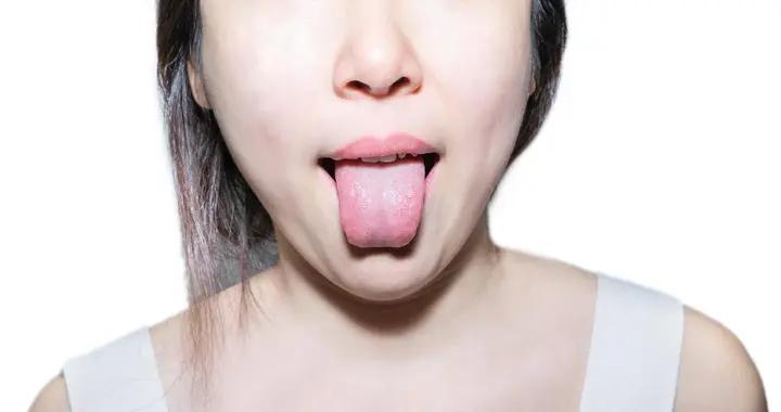 別讓溼氣拖垮身體！5個信號提示該祛溼，這些方法簡單又有效