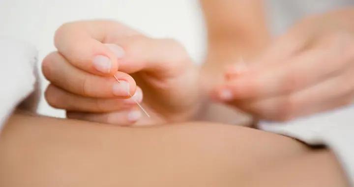 鍼灸後疼痛加重是壞事嗎？瞭解這些原因，避免盲目擔憂或忽視
