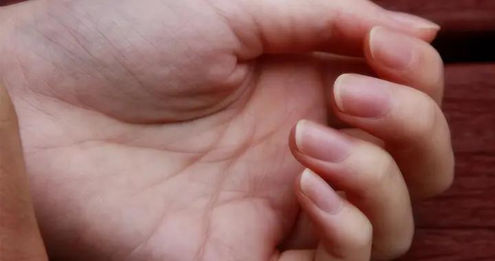 手指甲發白藏健康密碼？生理性vs病理性區分，正確應對看這裏