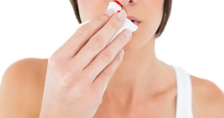 半夜流鼻血仰頭沒用！正確做法是這2步，很多人做錯了