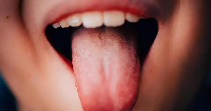 舌苔發黑+這些症狀要警惕！可能是身體在提醒你調理