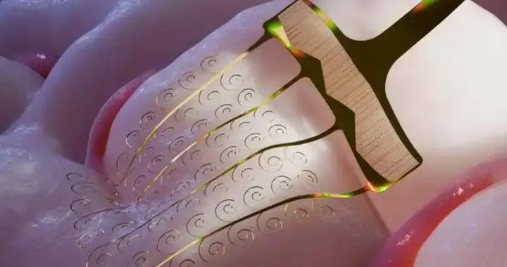 我國科學家攻克腦機接口“位移”瓶頸，植入更穩、損傷更小