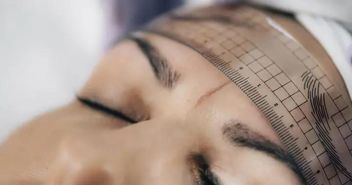 提眉術的“另一面”：效果不永久還可能留疤，你能接受嗎