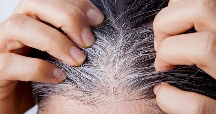 白髮長在哪，病就從哪來？這3處尤其要注意