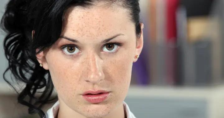 疑惑肝不好臉長斑？兩者有關聯，教你區分其他長斑誘因