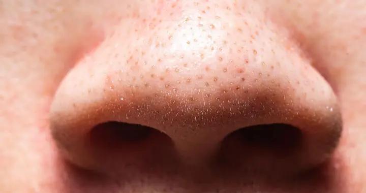 毛孔粗大愁人？從清潔到作息，一套組合拳幫你改善