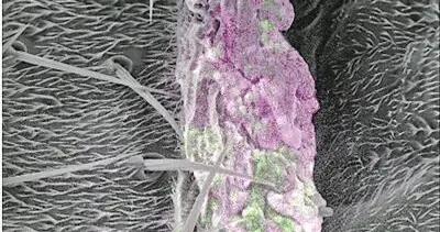 兼具電子顯微鏡與熒光顯微鏡雙重優勢 新成像技術能同步觀測細胞精細結構