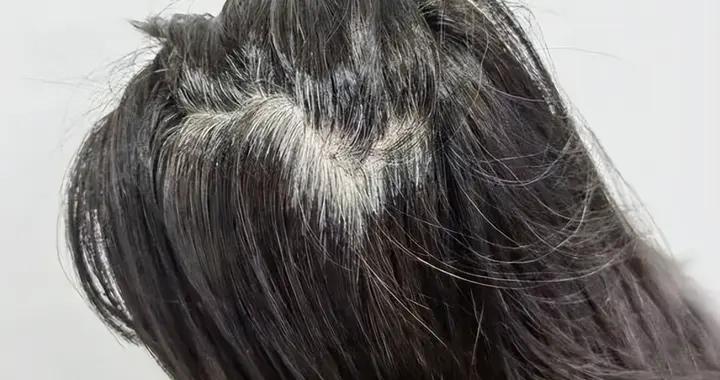 最新研究：長白頭髮的人不易患癌？科學家揭祕背後原因